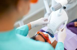 ¿En qué consiste el nuevo BLANQUEAMIENTO DENTAL PHILIPS?