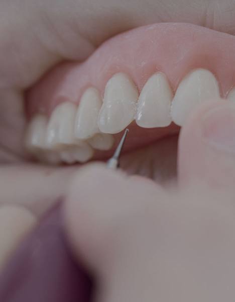 Protésicos dentales